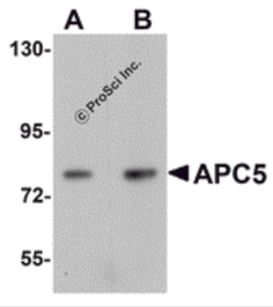 Western blot analysis of APC5 in human kidney tissue lysate with APC5 antibody at (A) 1 and (B) 2 μg/mL.