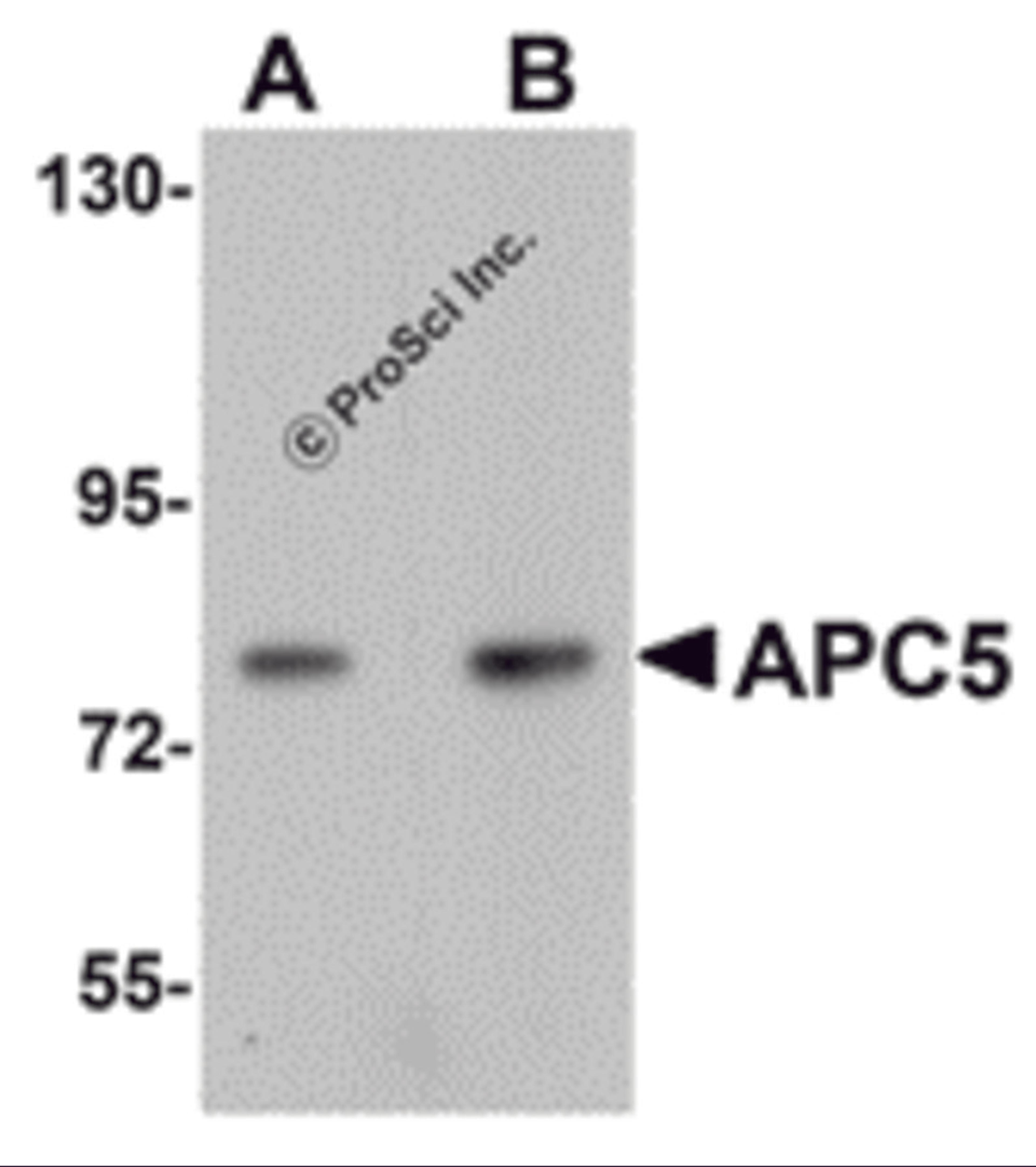 Western blot analysis of APC5 in human kidney tissue lysate with APC5 antibody at (A) 1 and (B) 2 μg/mL.