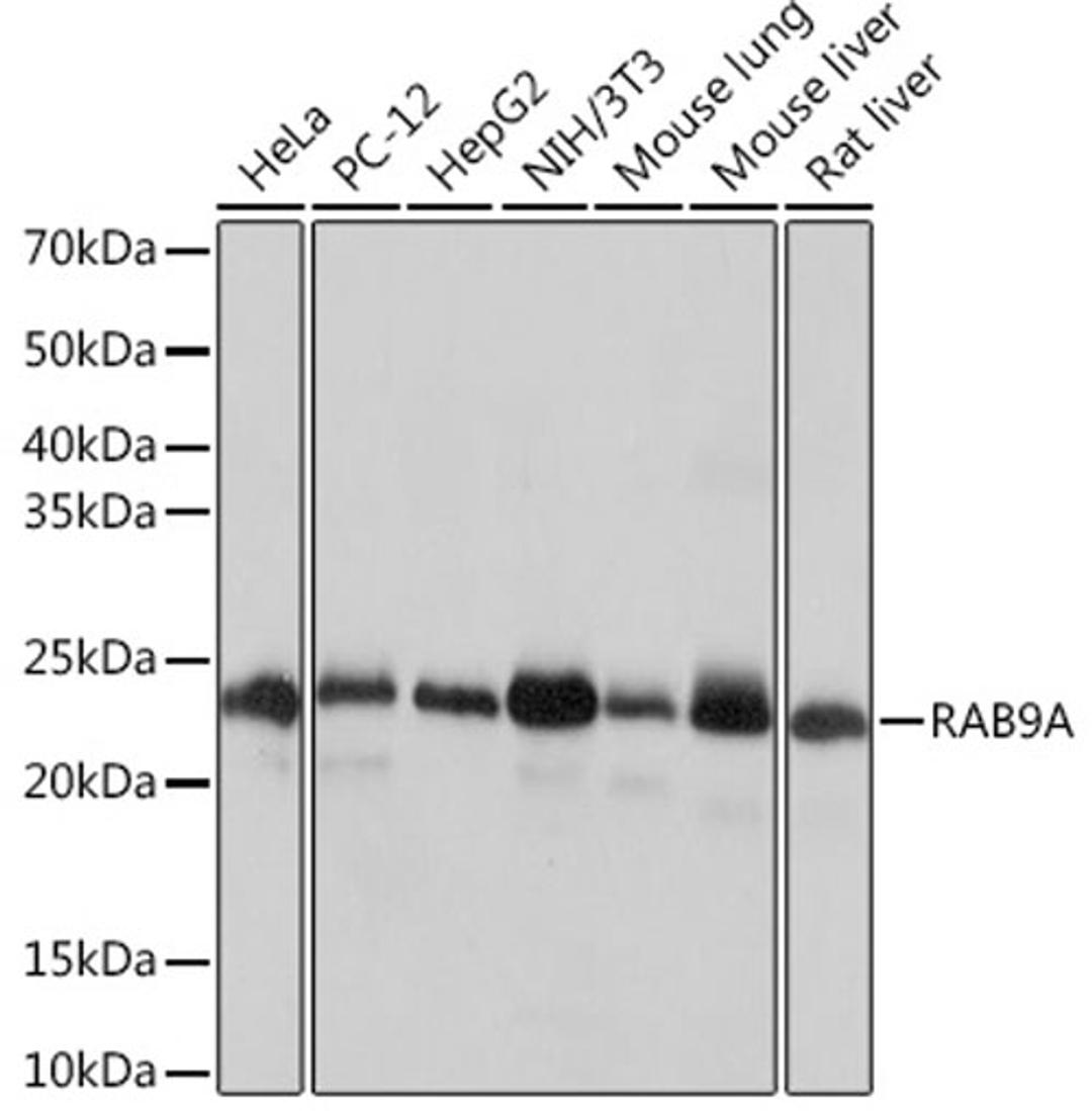 Western blot - RAB9A Rabbit mAb (A4894)