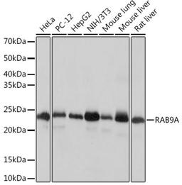 Western blot - RAB9A Rabbit mAb (A4894)