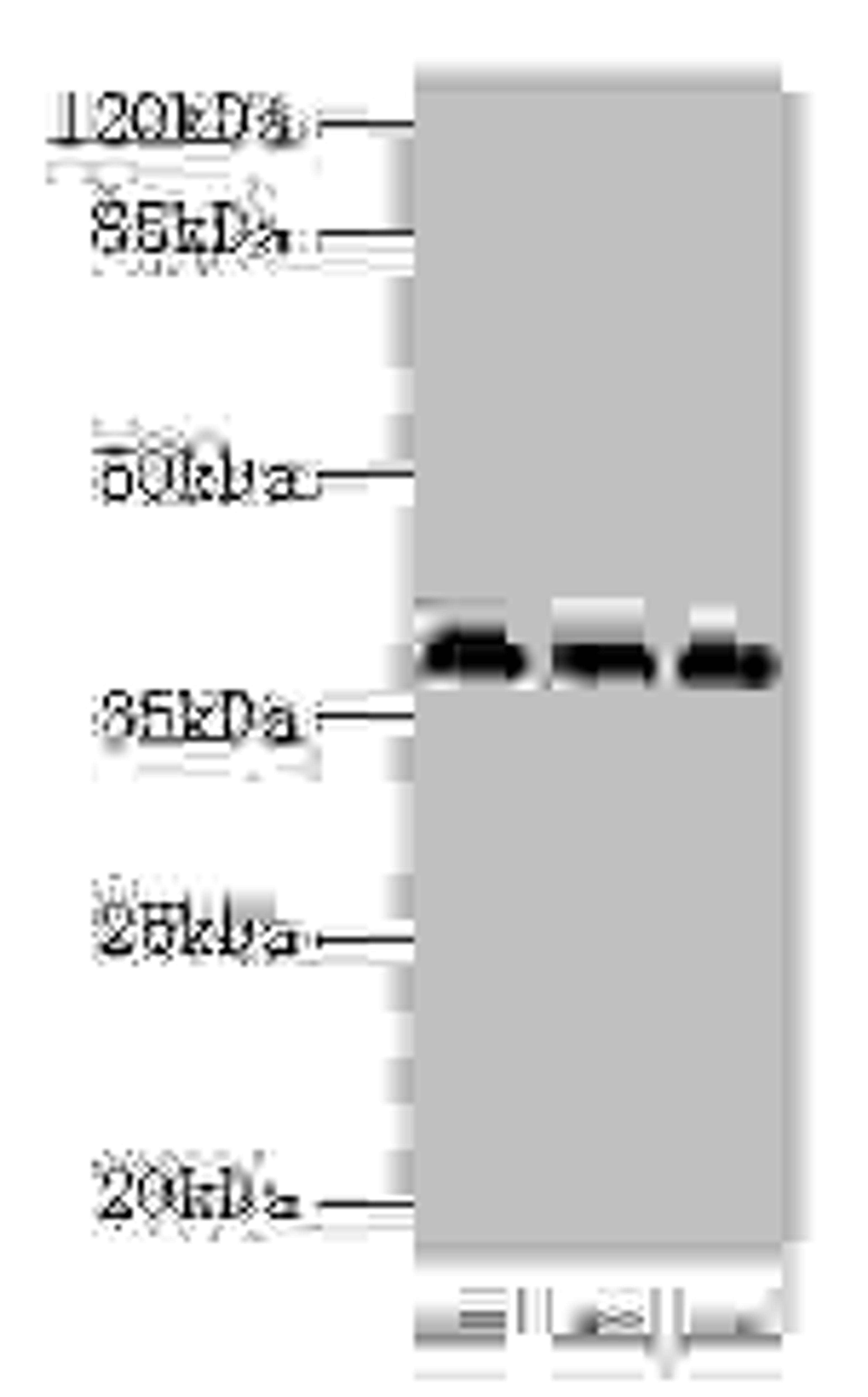 Western blot. All lanes: HNRNPD antibody at 2µg/ml. Lane 1: 293T whole cell lysate. Lane 2: Hela whole cell lysate. Lane 3: Jurkat whole cell lysate. Secondary. Goat polyclonal to rabbit IgG at 1/10000 dilution. Predicted band size: 39, 37, 33, 31 kDa. Observed band size: 39 kDa