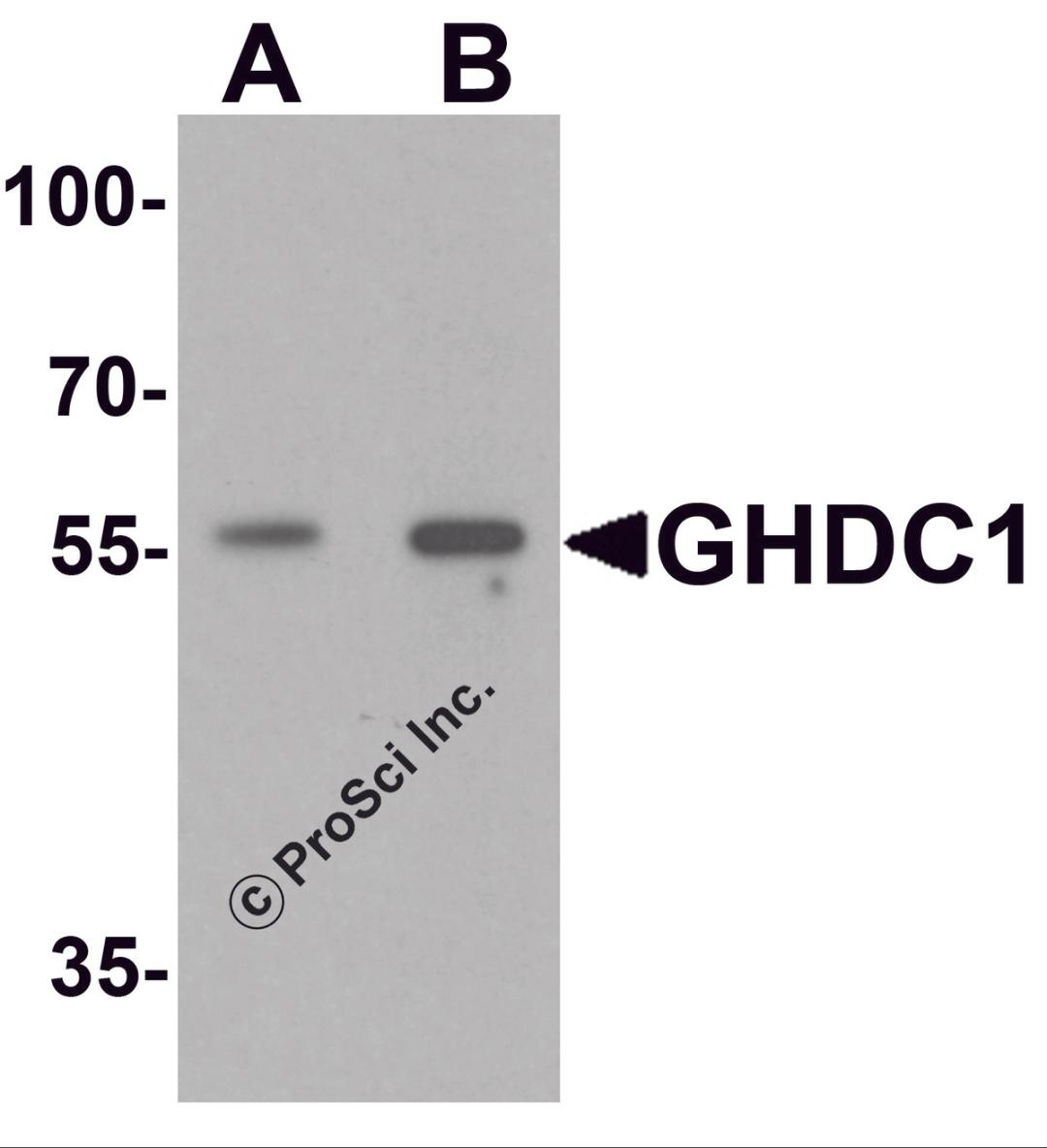 Western blot analysis of GHDC in 293 cell lysate with GHDC antibody at (A) 0.5 and (B) 1 &#956;g/mL.