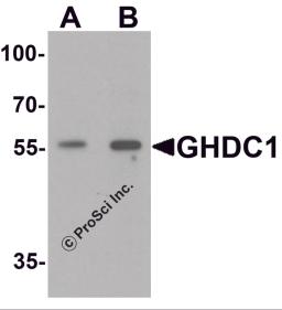 Western blot analysis of GHDC in 293 cell lysate with GHDC antibody at (A) 0.5 and (B) 1 &#956;g/mL.