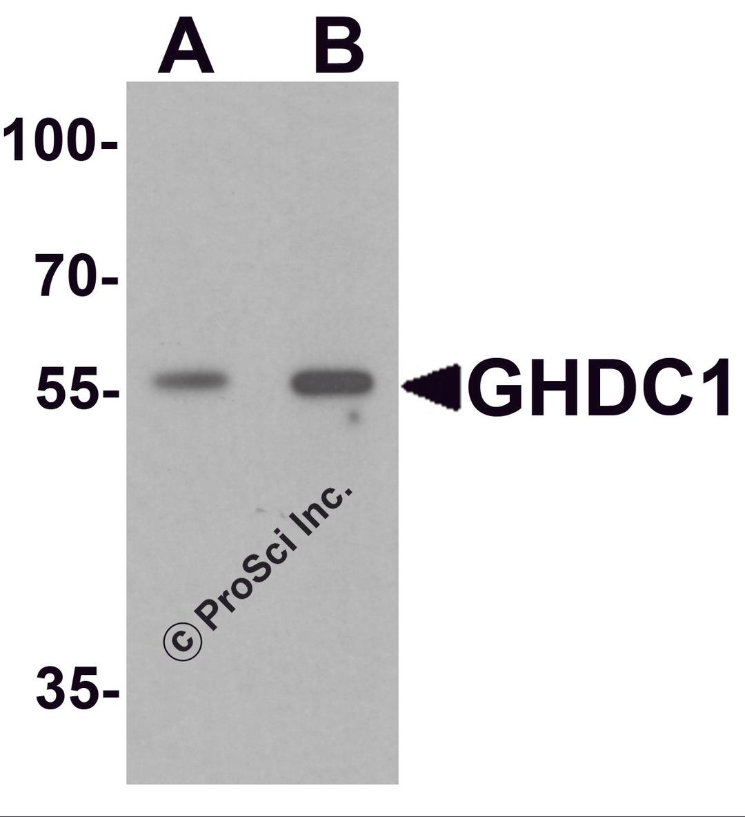 Western blot analysis of GHDC in 293 cell lysate with GHDC antibody at (A) 0.5 and (B) 1 μg/mL.