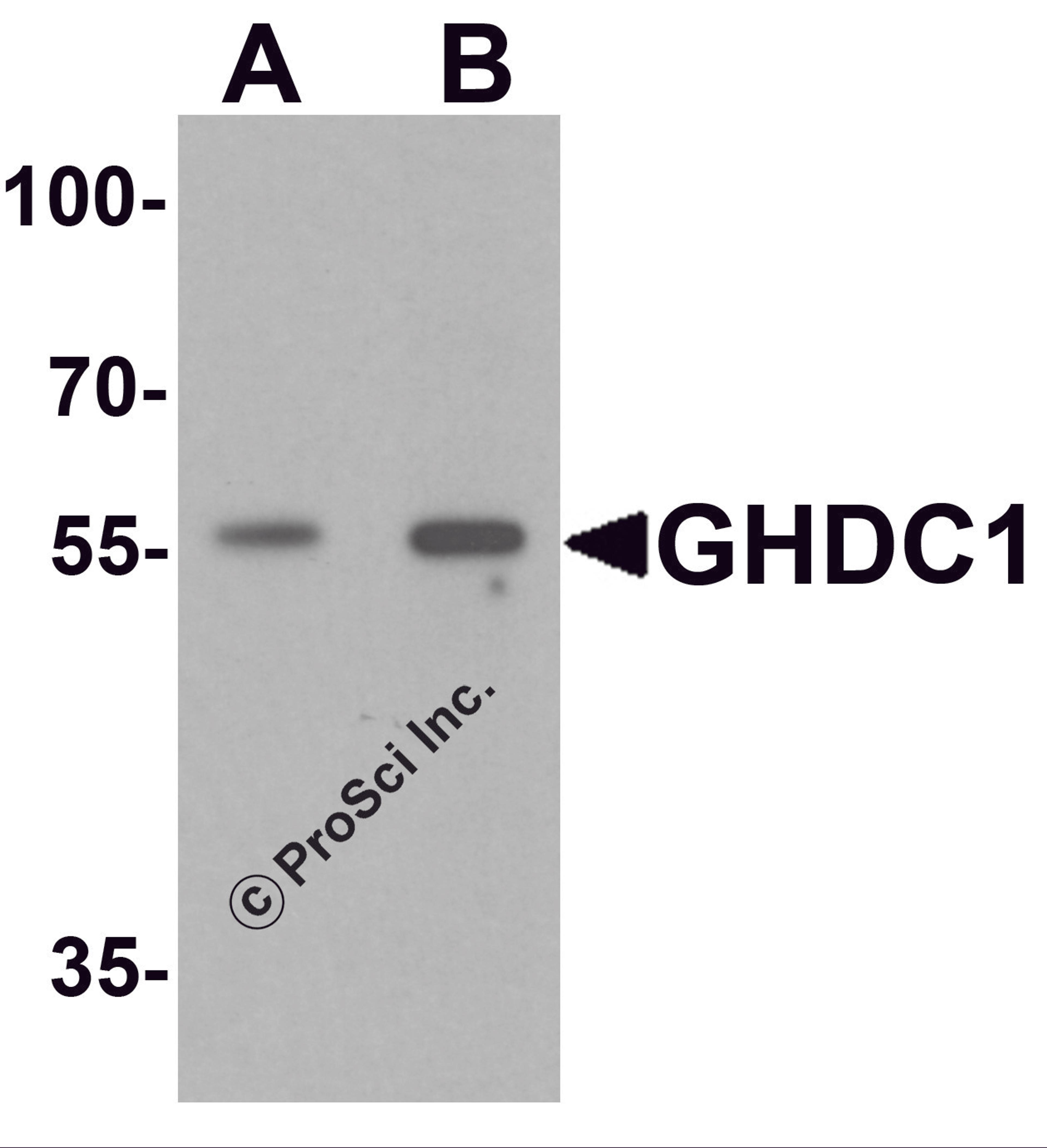 Western blot analysis of GHDC in 293 cell lysate with GHDC antibody at (A) 0.5 and (B) 1 μg/mL.
