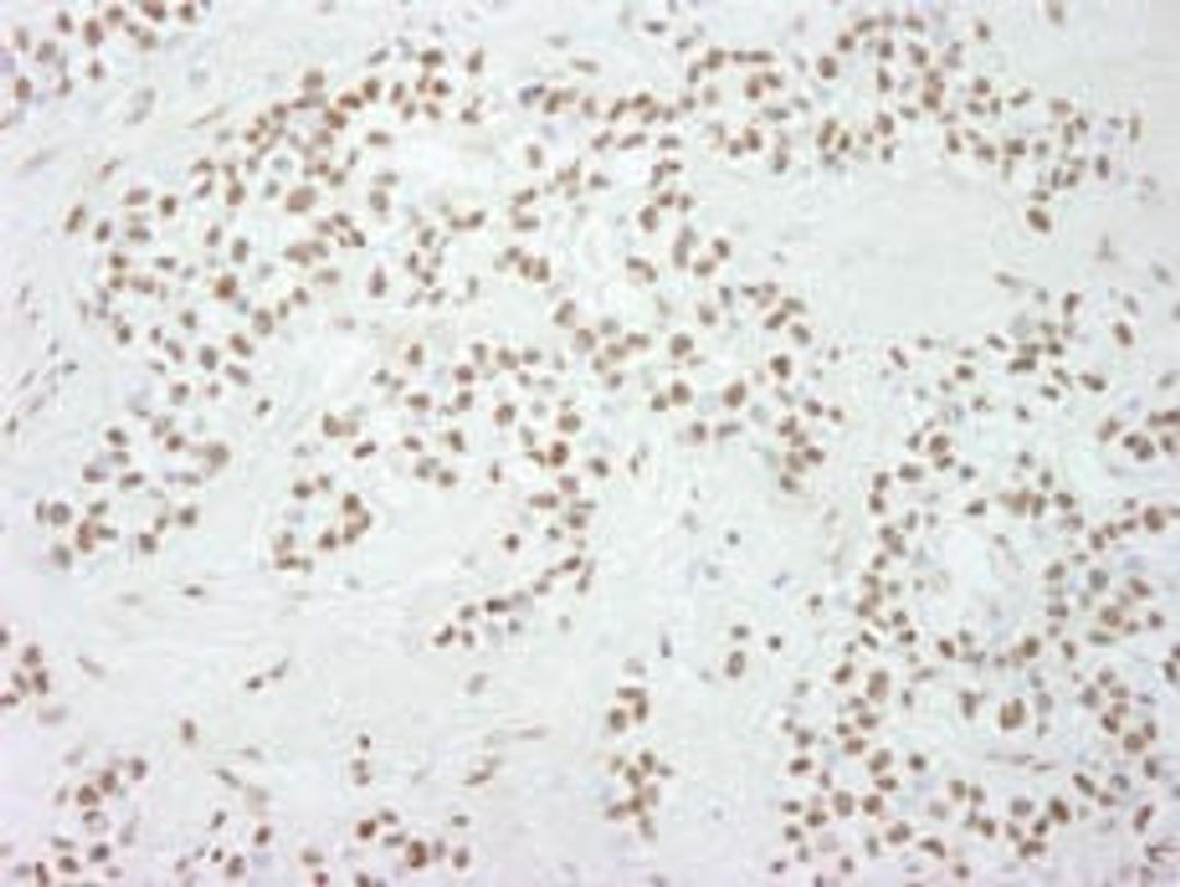 Detection of human Sp1 by immunohistochemistry.