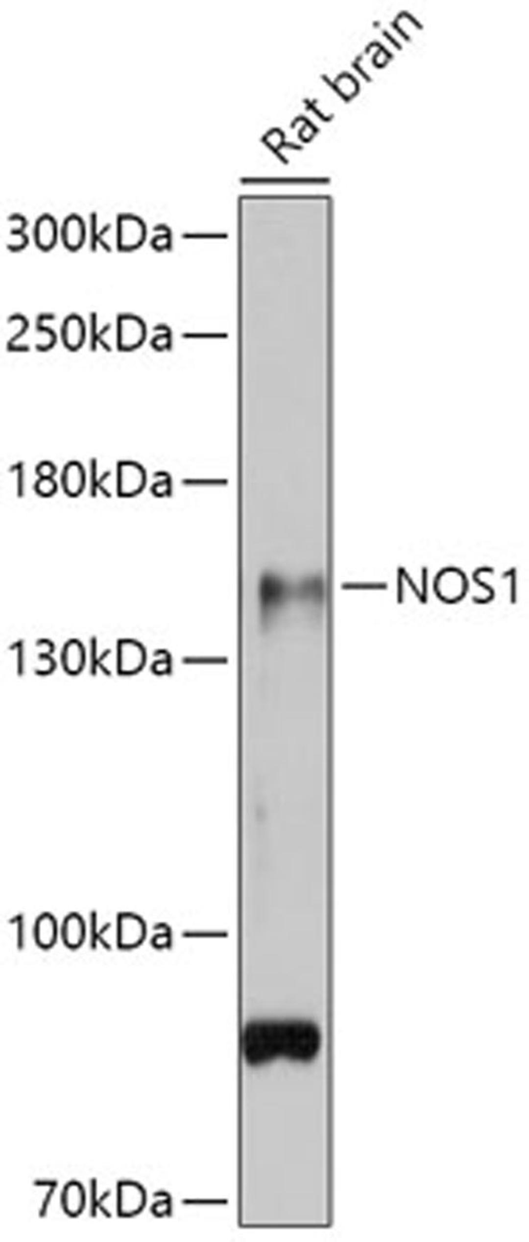 Western blot - NOS1 antibody (A12795)