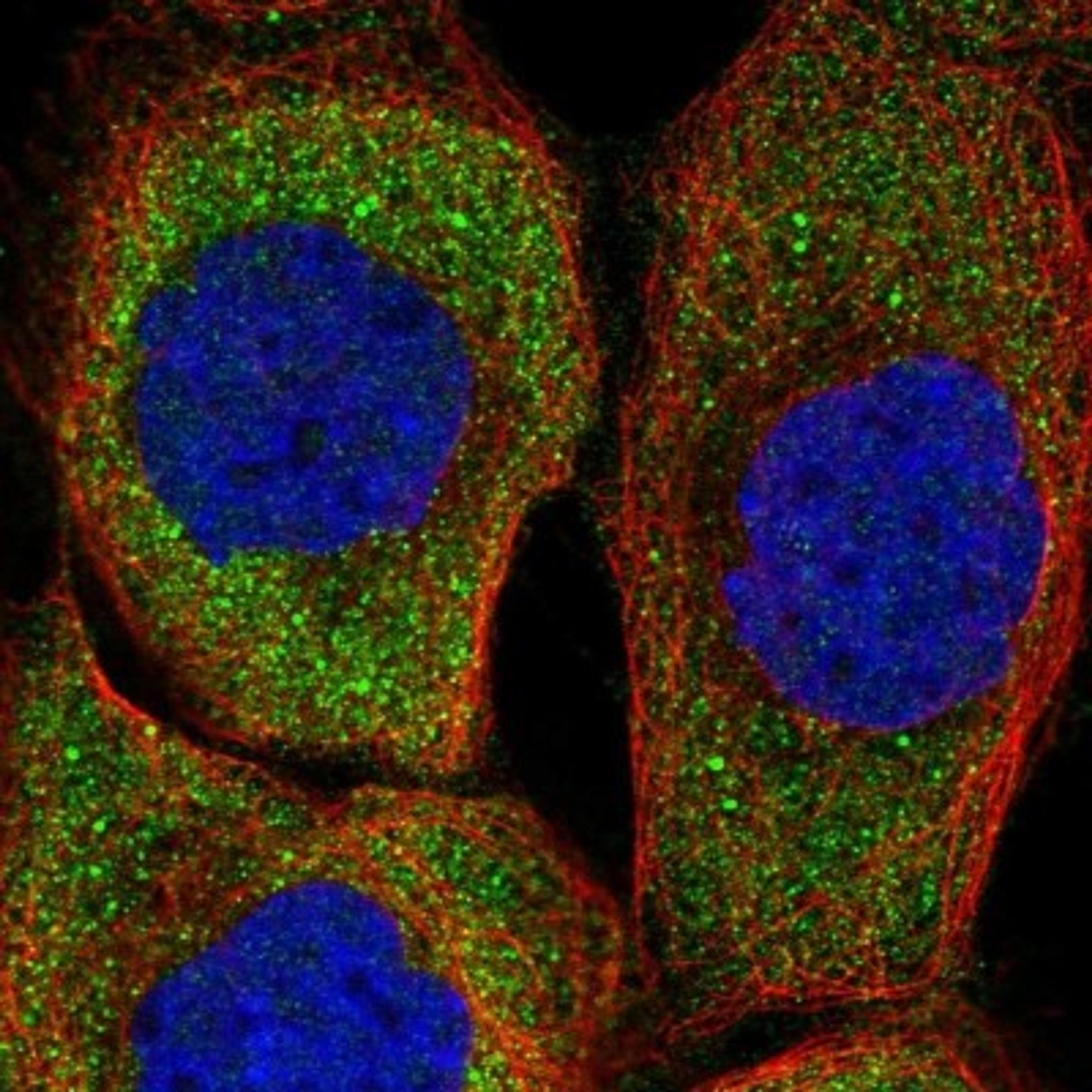 Immunocytochemistry/Immunofluorescence: ZNF598 Antibody [NBP1-84658] - Staining of human cell line A-431 shows positivity in cytoplasm.