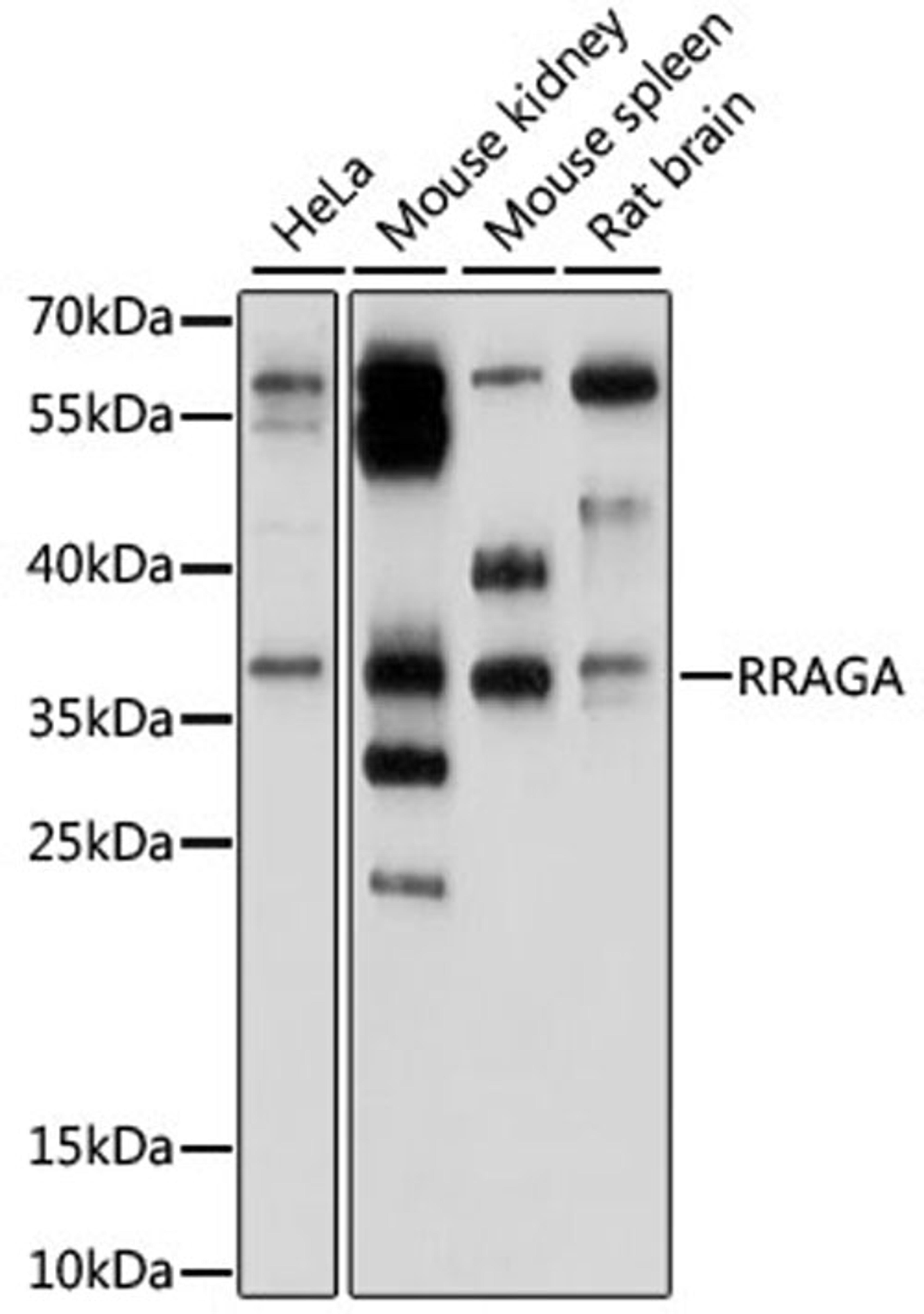 Western blot - RRAGA antibody (A15134)