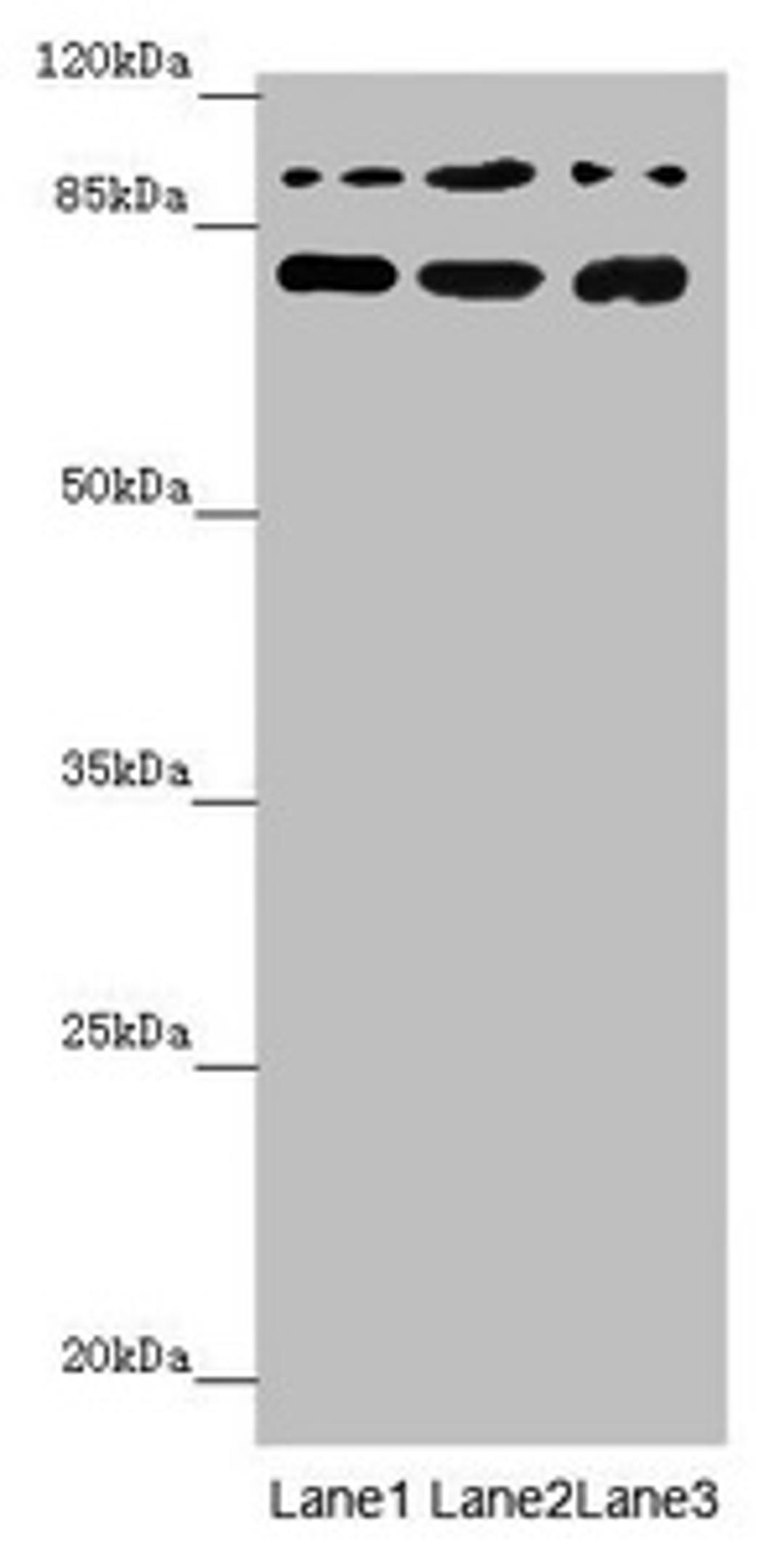 Western blot. All lanes: COG5 antibody at 2.04 ug/ml. Lane 1: Mouse large intestine tissue. Lane 2: A549 whole cell lysate. Lane 3: 293T whole cell lysate. Secondary. Goat polyclonal to rabbit IgG at 1/10000 dilution. Predicted band size: 93, 95, 91 kDa. Observed band size: 93, 70 kDa. 
