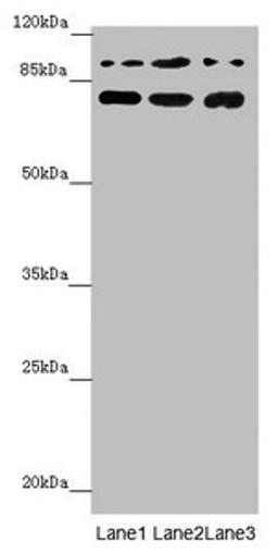 Western blot. All lanes: COG5 antibody at 2.04 ug/ml. Lane 1: Mouse large intestine tissue. Lane 2: A549 whole cell lysate. Lane 3: 293T whole cell lysate. Secondary. Goat polyclonal to rabbit IgG at 1/10000 dilution. Predicted band size: 93, 95, 91 kDa. Observed band size: 93, 70 kDa. 