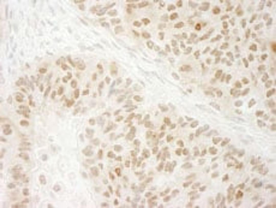 Detection of human G9A/EHMT2 by immunohistochemistry.