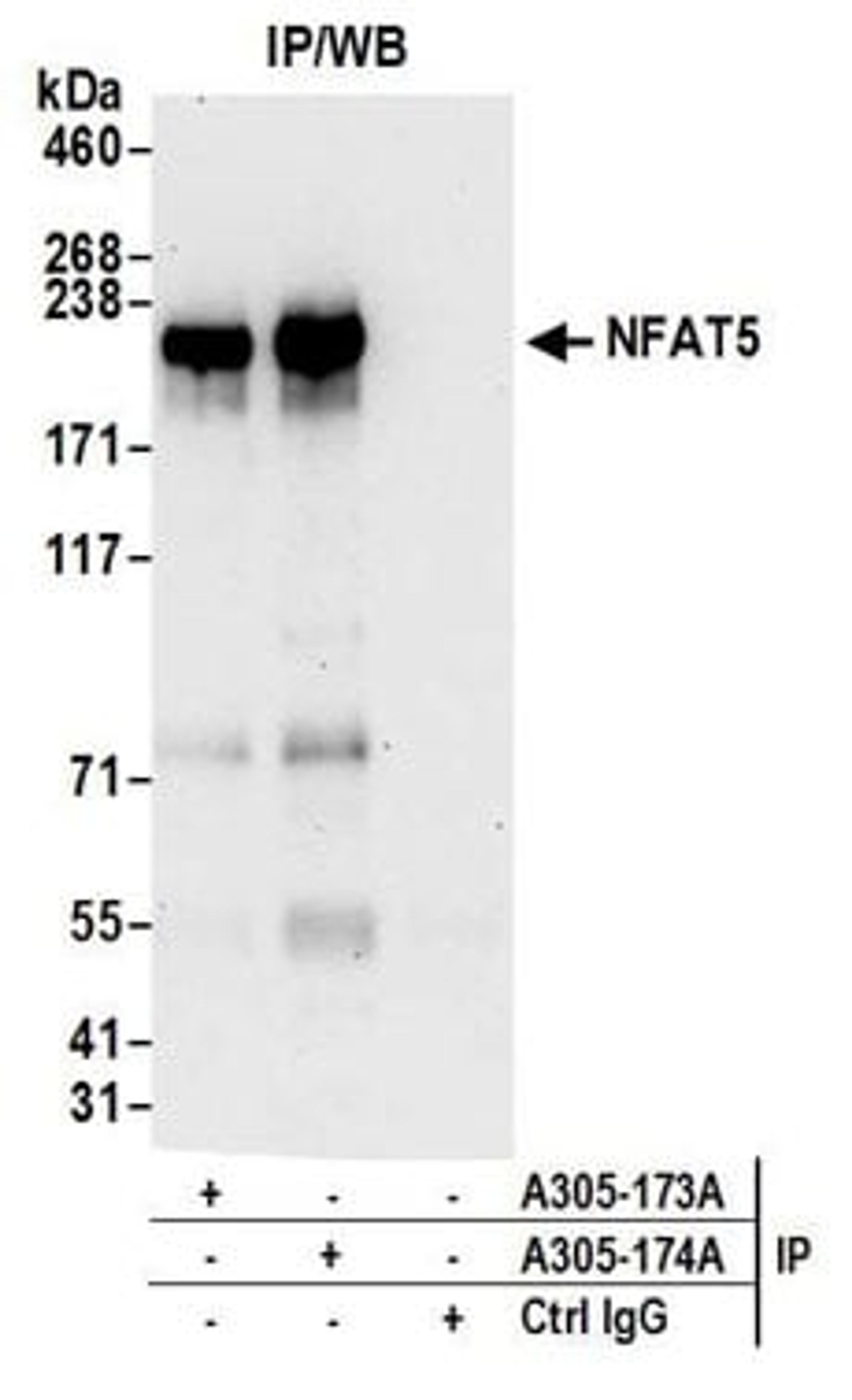 Detection of human NFAT5 by western blot of immunoprecipitates.