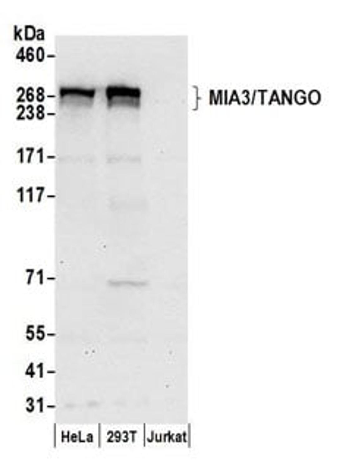 Detection of human MIA3/TANGO by western blot.