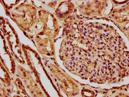 IHC image of CSB-PA010380OA147nme1HU diluted at 1:10 and staining in paraffin-embedded human kidney tissue performed on a Leica BondTM system. After dewaxing and hydration, antigen retrieval was mediated by high pressure in a citrate buffer (pH 6.0). Section was blocked with 10% normal goat serum 30min at RT. Then primary antibody (1% BSA) was incubated at 4°C overnight. The primary is detected by a biotinylated secondary antibody and visualized using an HRP conjugated SP system.
