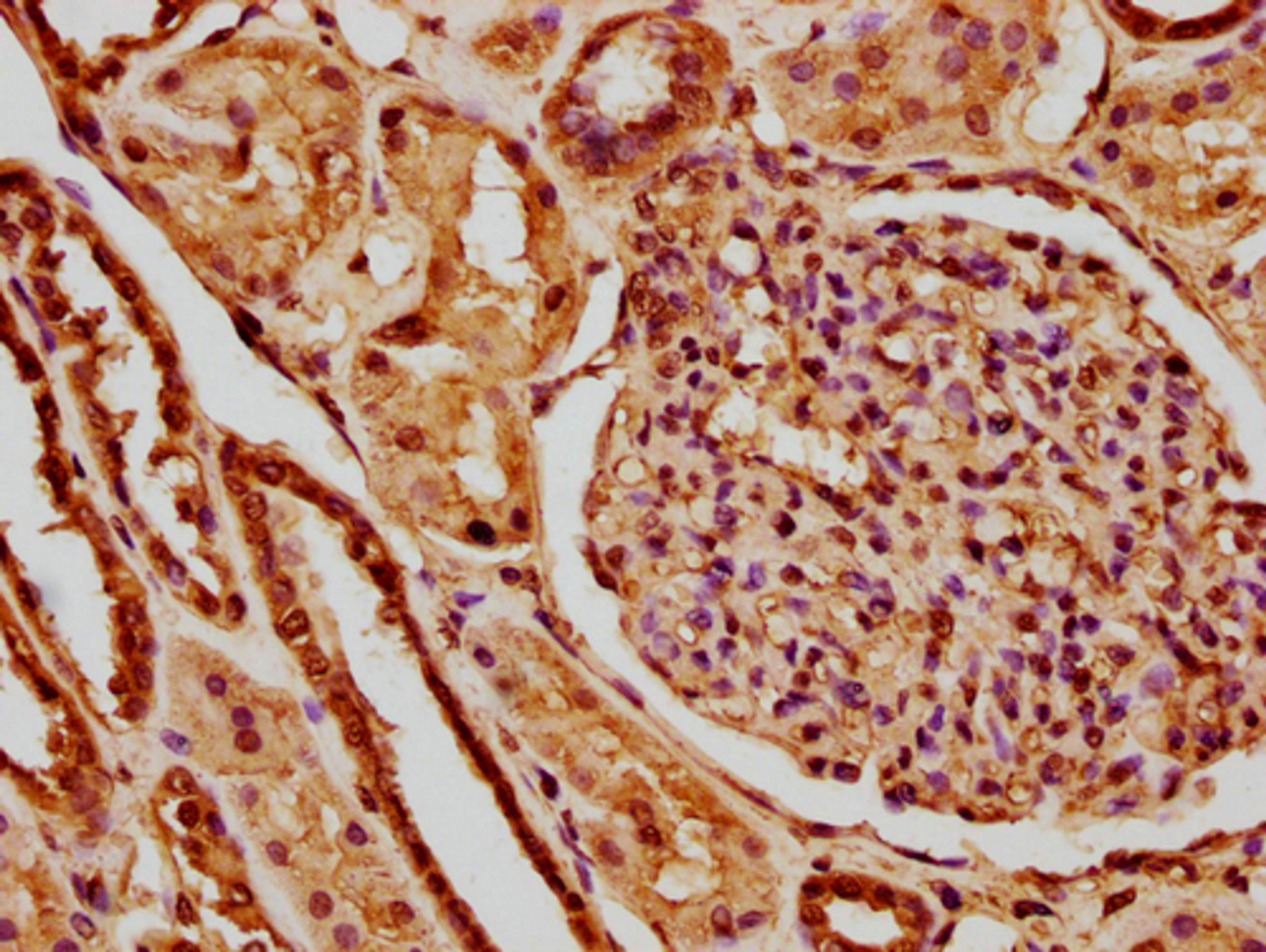 IHC image of CSB-PA010380OA147nme1HU diluted at 1:10 and staining in paraffin-embedded human kidney tissue performed on a Leica BondTM system. After dewaxing and hydration, antigen retrieval was mediated by high pressure in a citrate buffer (pH 6.0). Section was blocked with 10% normal goat serum 30min at RT. Then primary antibody (1% BSA) was incubated at 4°C overnight. The primary is detected by a biotinylated secondary antibody and visualized using an HRP conjugated SP system.