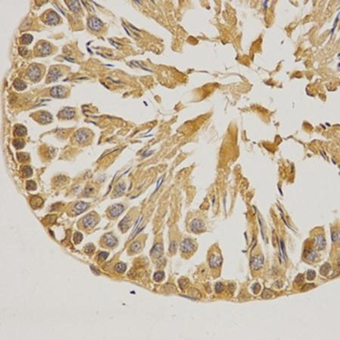 IHC-P staining of rat testis tissue using SUMO1 antibody (primary antibody dilution at 1:200)