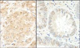 Detection of human MEK1 by immunohistochemistry.