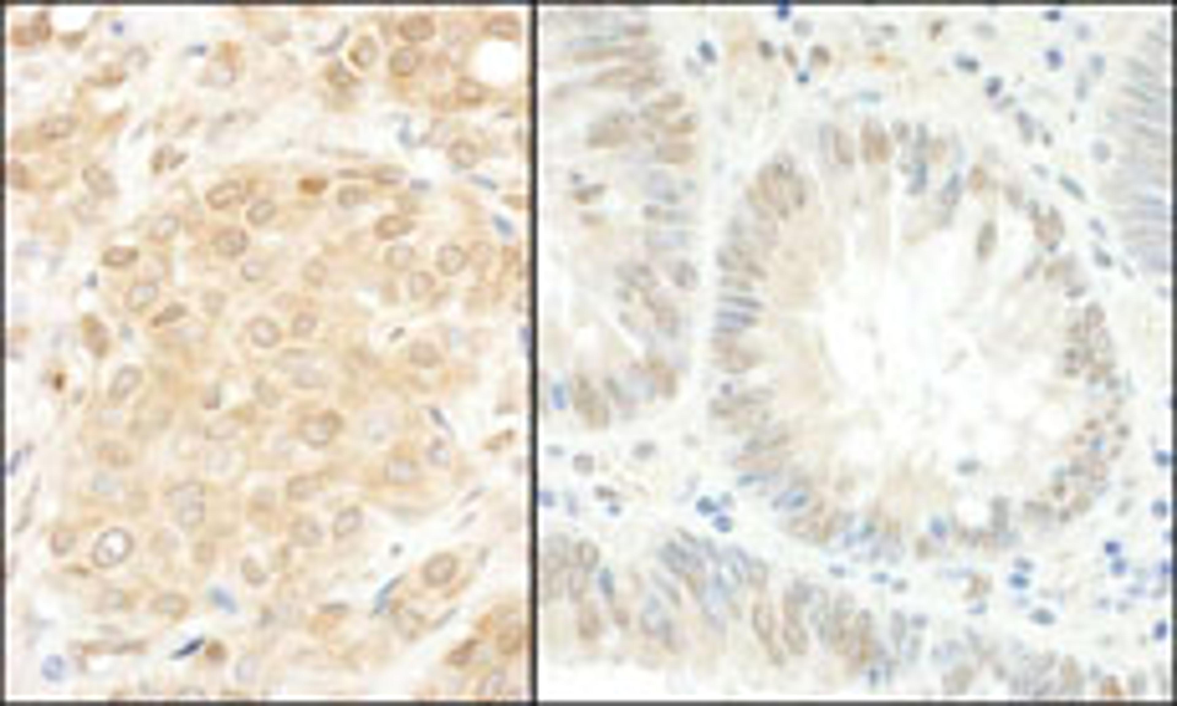 Detection of human MEK1 by immunohistochemistry.