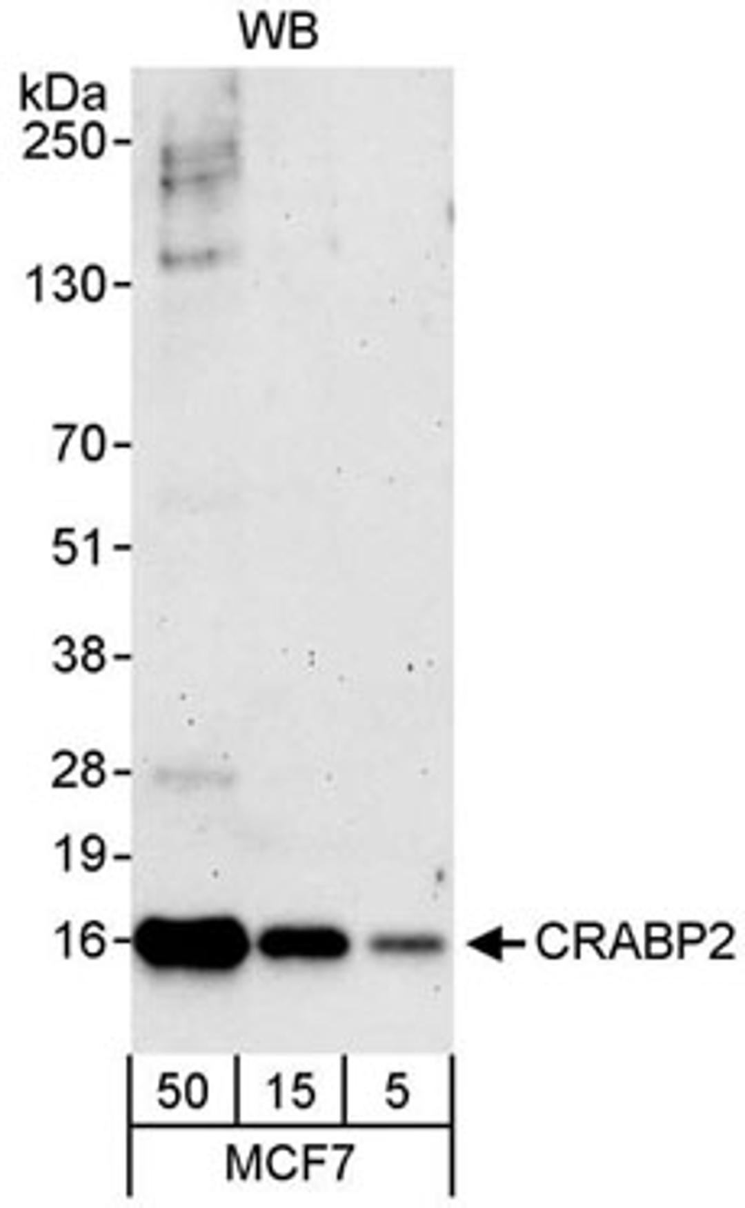 Detection of human CRABP2 by western blot.