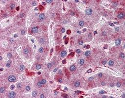 Immunohistochemistry-Paraffin: ACP2 Antibody [NBP1-62491] - Human Liver tissue, 5 ug/ml.