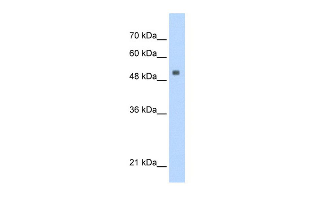 Antibody used in WB on Human HepG2 at 0.125 ug/ml.