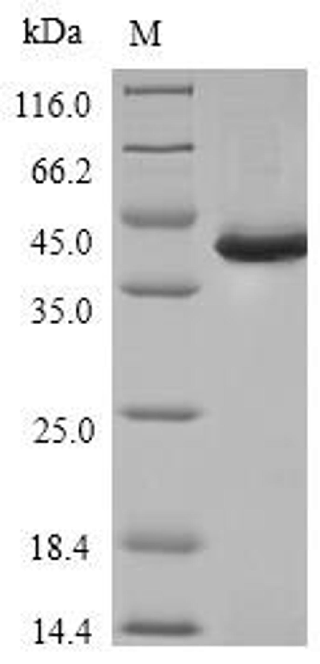 (Tris-Glycine gel) Discontinuous SDS-PAGE (reduced) with 5% enrichment gel and 15% separation gel.