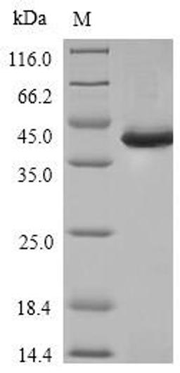 (Tris-Glycine gel) Discontinuous SDS-PAGE (reduced) with 5% enrichment gel and 15% separation gel.