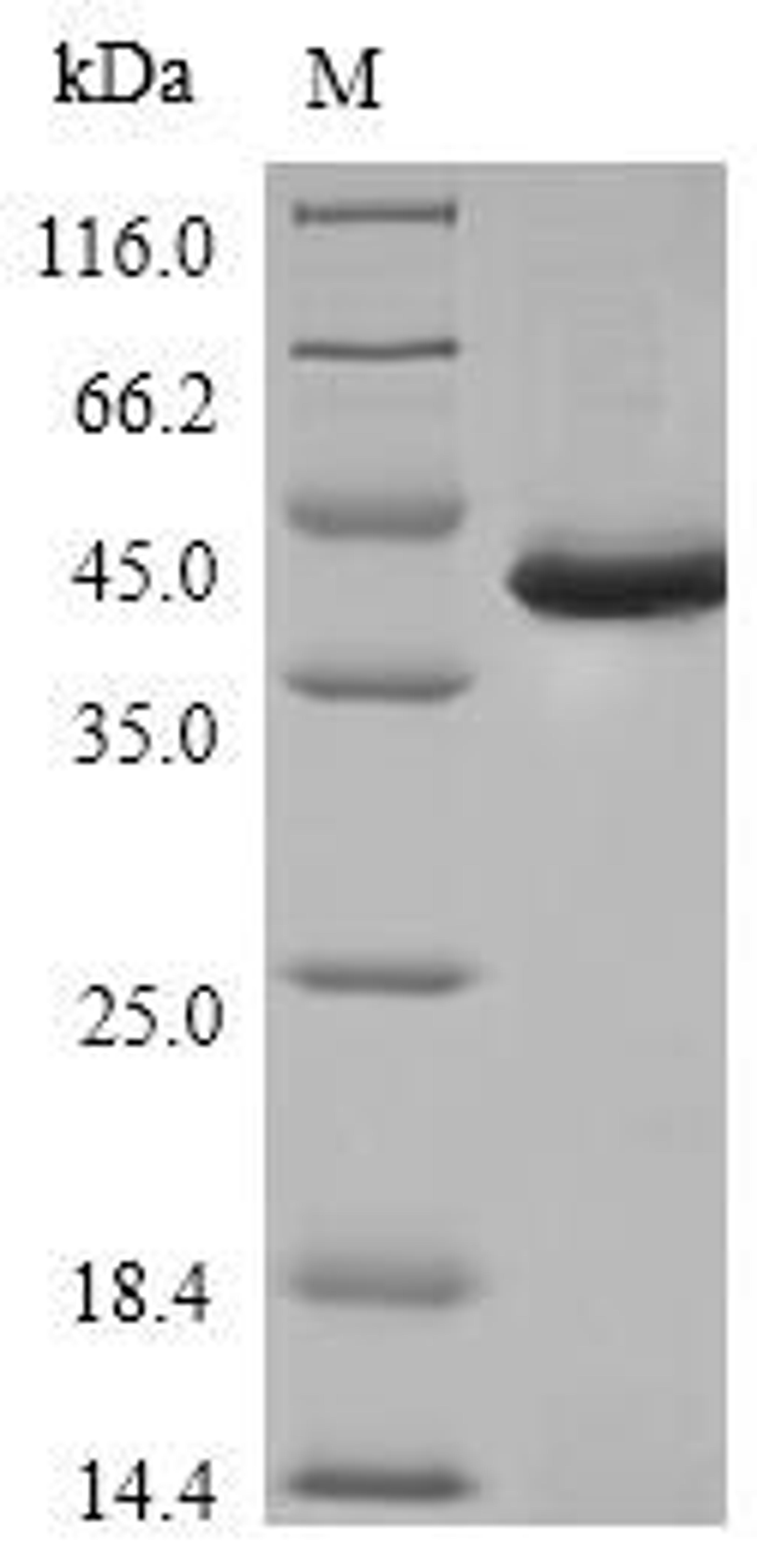 (Tris-Glycine gel) Discontinuous SDS-PAGE (reduced) with 5% enrichment gel and 15% separation gel.