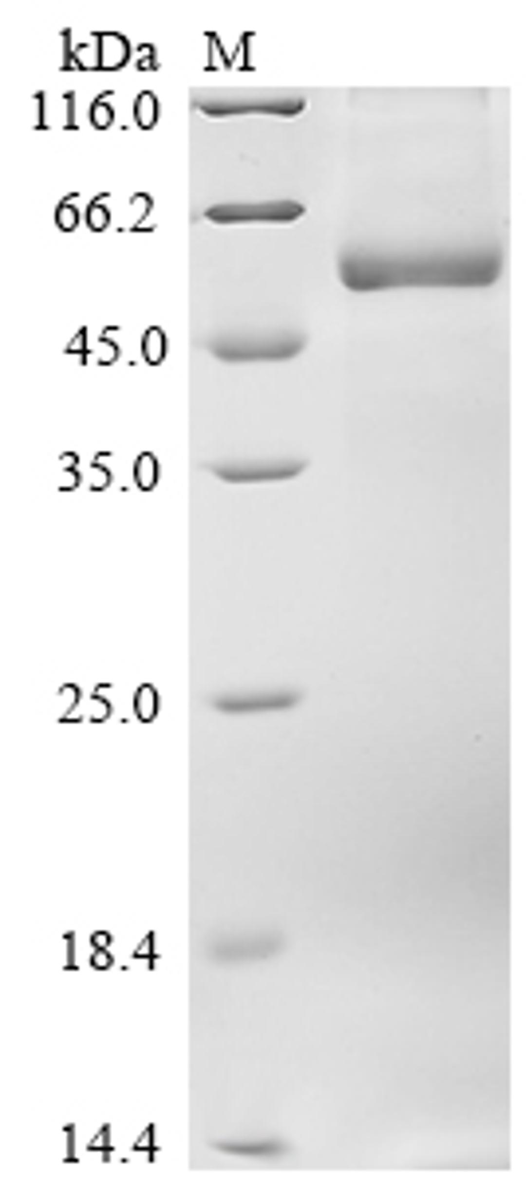 (Tris-Glycine gel) Discontinuous SDS-PAGE (reduced) with 5% enrichment gel and 15% separation gel.
