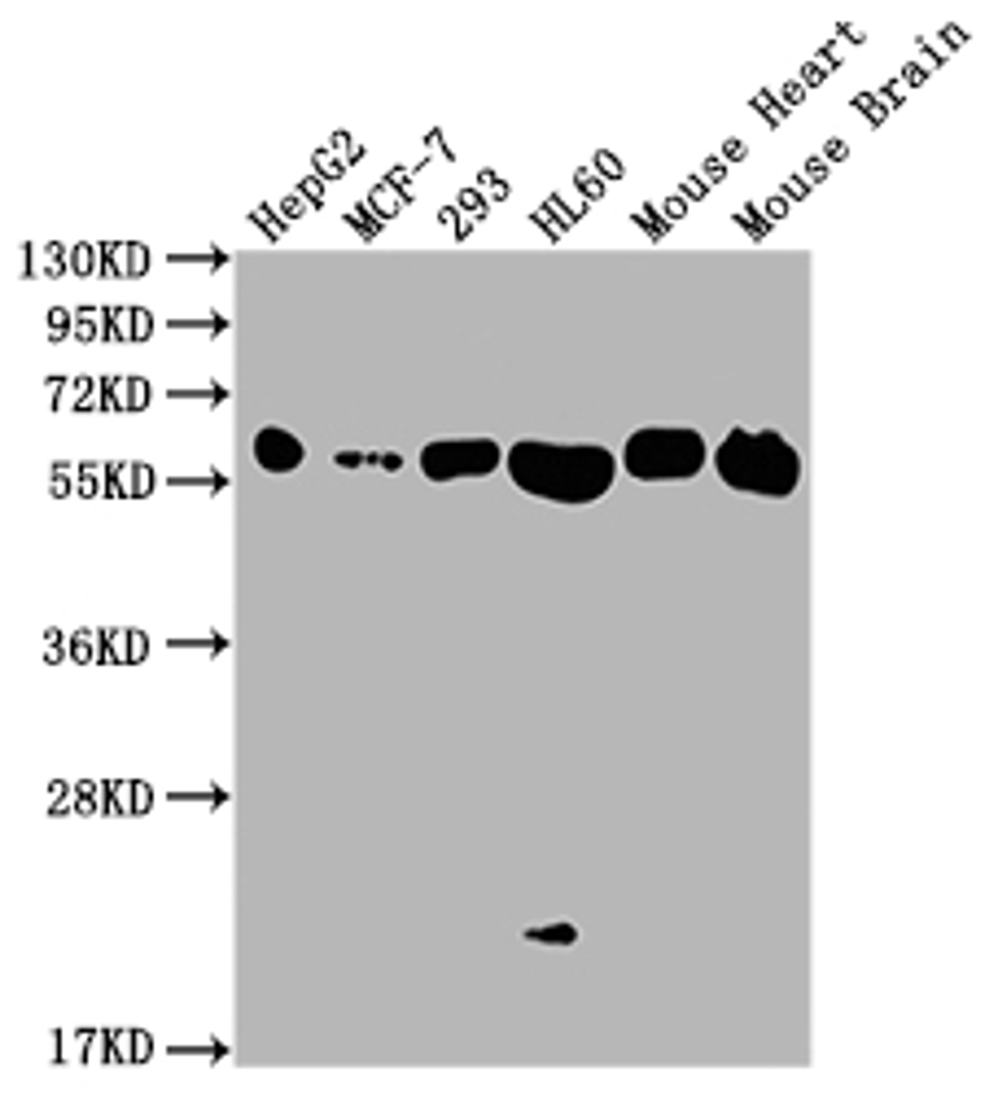 Western Blot. Positive WB detected in: HepG2 whole cell lysate, MCF-7 whole cell lysate, 293 whole cell lysate, HL60 whole cell lysate, Mouse Heart tissue, Mouse Brain tissue. All lanes: ATP5F1A antibody at 1:2000. Secondary. Goat polyclonal to rabbit IgG at 1/50000 dilution. Predicted band size: 60, 55, 58 kDa. Observed band size: 60 kDa.
