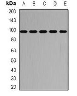 Western blot analysis of SW620 (Lane1), HT29 (Lane2), mouse heart (Lane3), mouse lung (Lane4), rat brain (Lane5) whole cell lysates using PYGB antibody