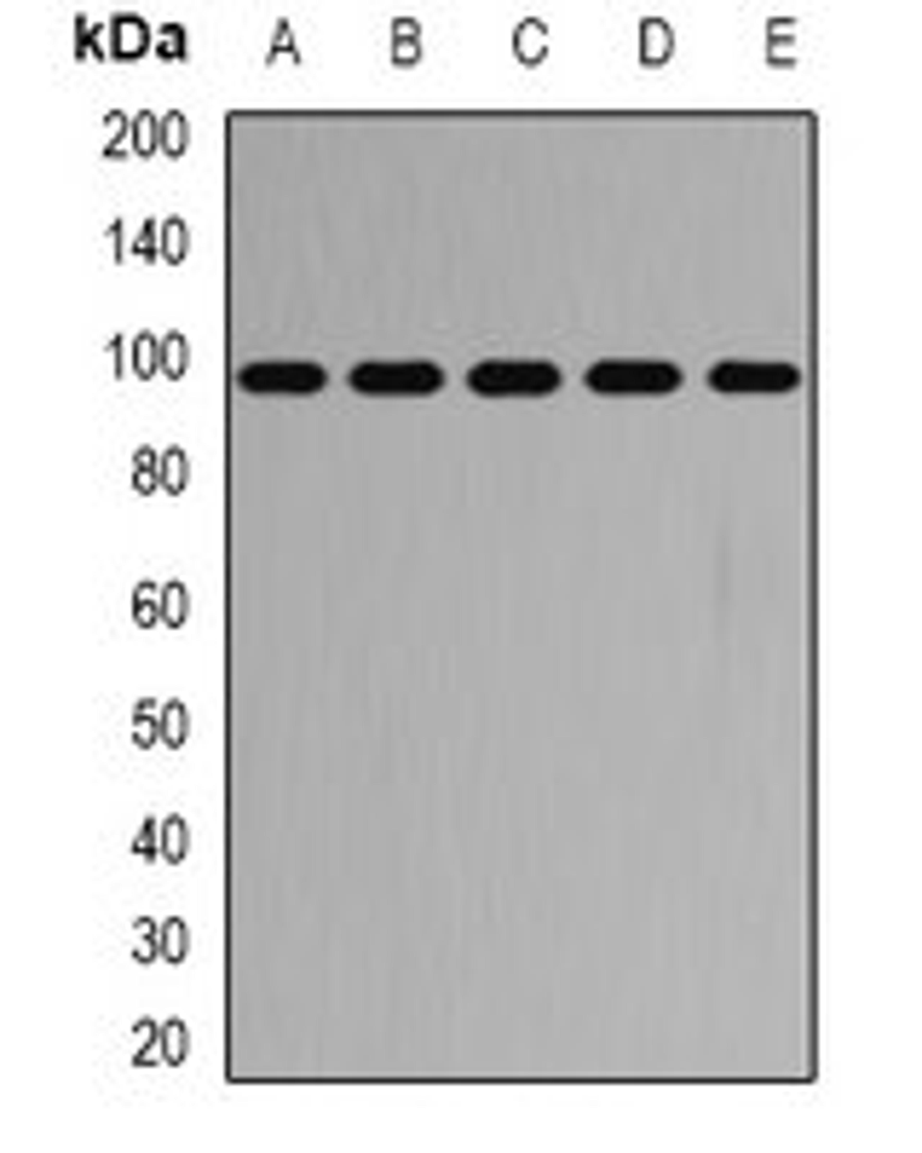 Western blot analysis of SW620 (Lane1), HT29 (Lane2), mouse heart (Lane3), mouse lung (Lane4), rat brain (Lane5) whole cell lysates using PYGB antibody