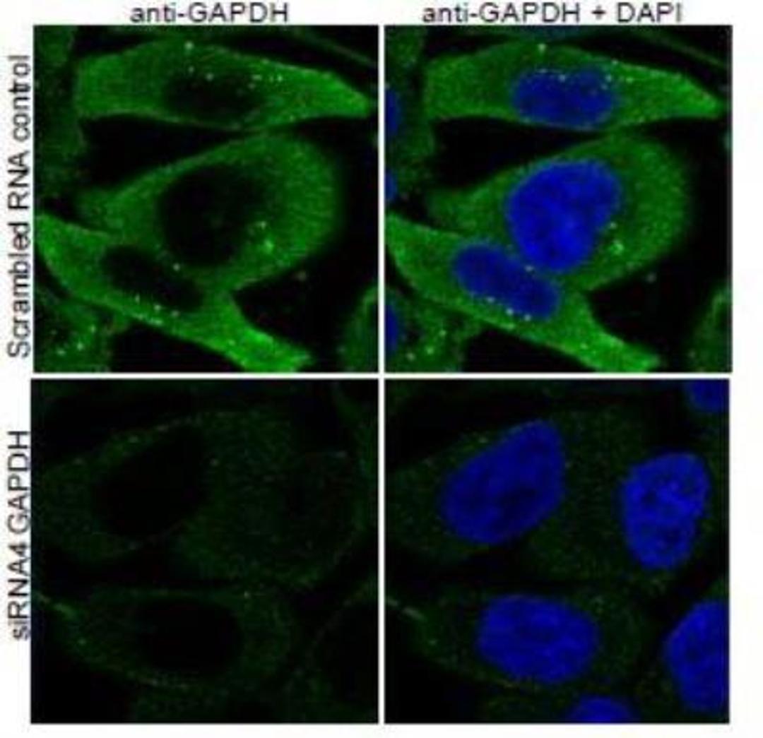 Immunocytochemistry: GAPDH Antibody [NB300-320] - Staining of PFA-fixed HeLa before (top) and after (bottom) si-RNA-mediated GAPDH knock-down expresson. Primary incubation 1h at ambient temp. Detection by DyLight 488. Nuclear DAPI stain (right).