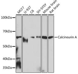 Western blot - Calcineurin A Rabbit mAb (A4346)