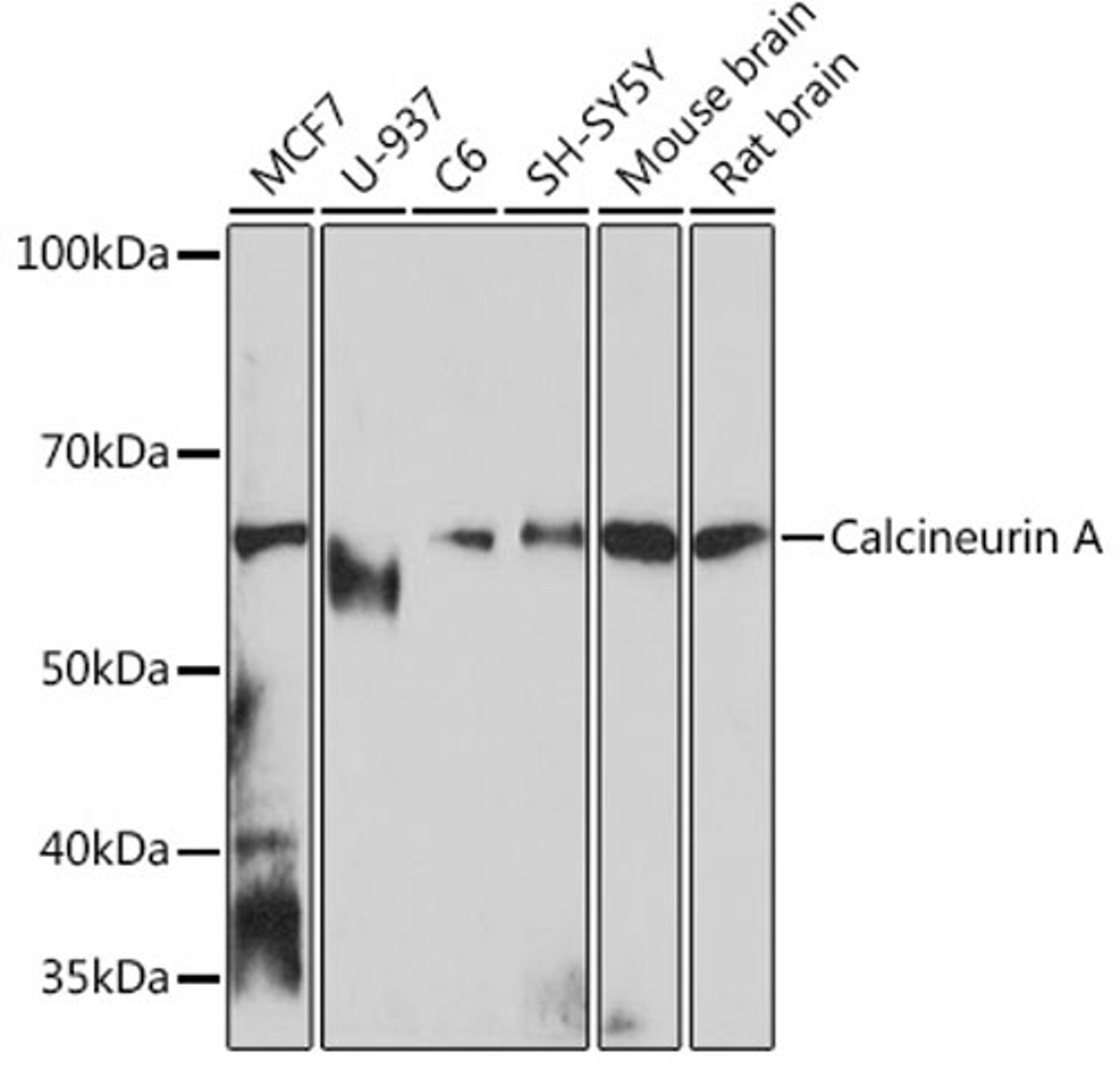 Western blot - Calcineurin A Rabbit mAb (A4346)