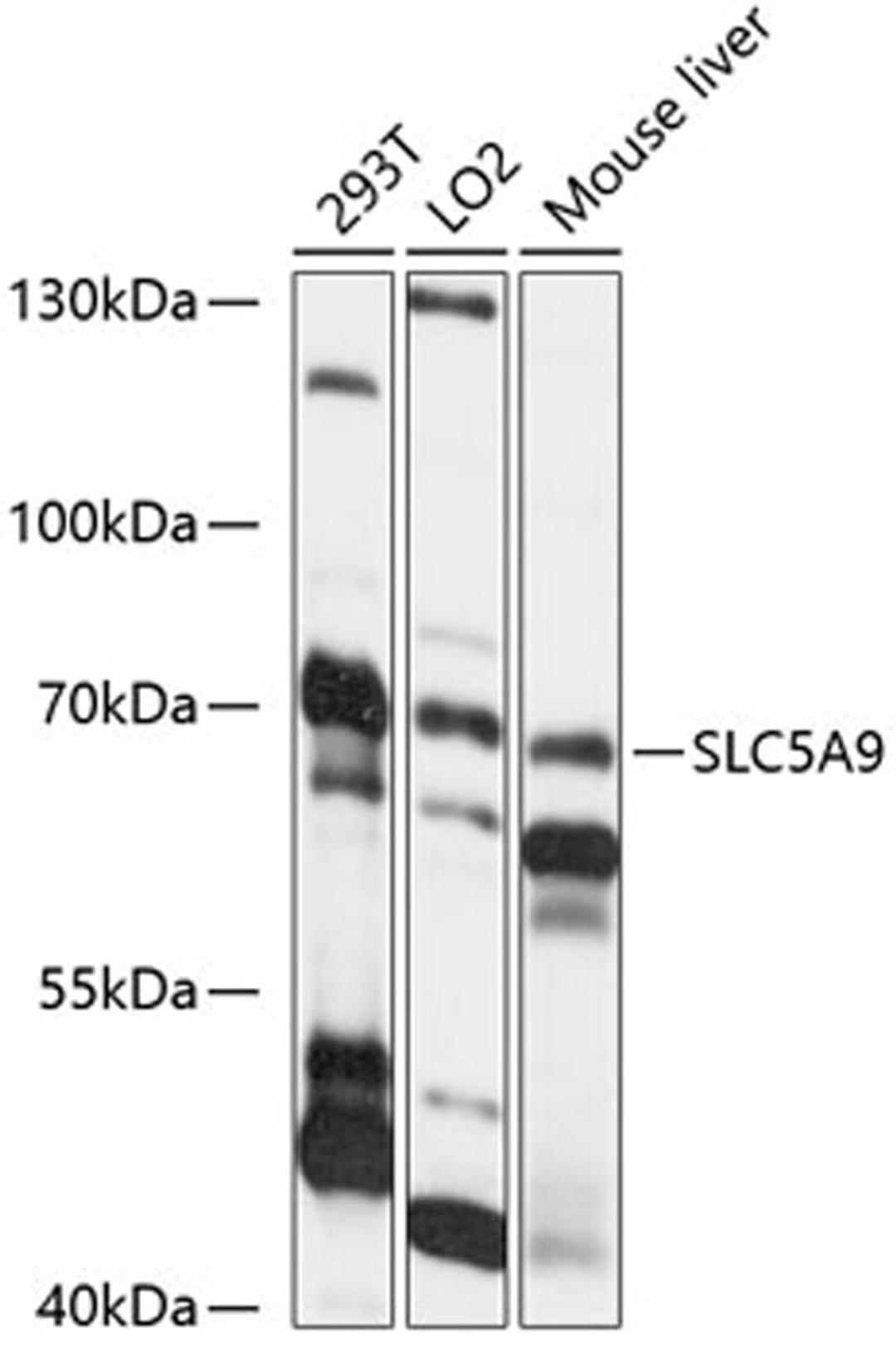 Western blot - SLC5A9 antibody (A14976)