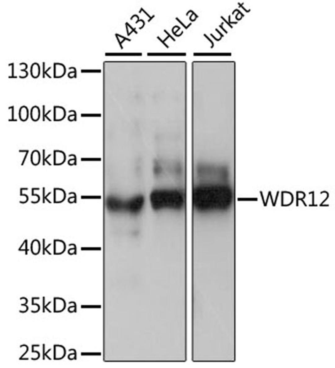 Western blot - WDR12 antibody (A15477)