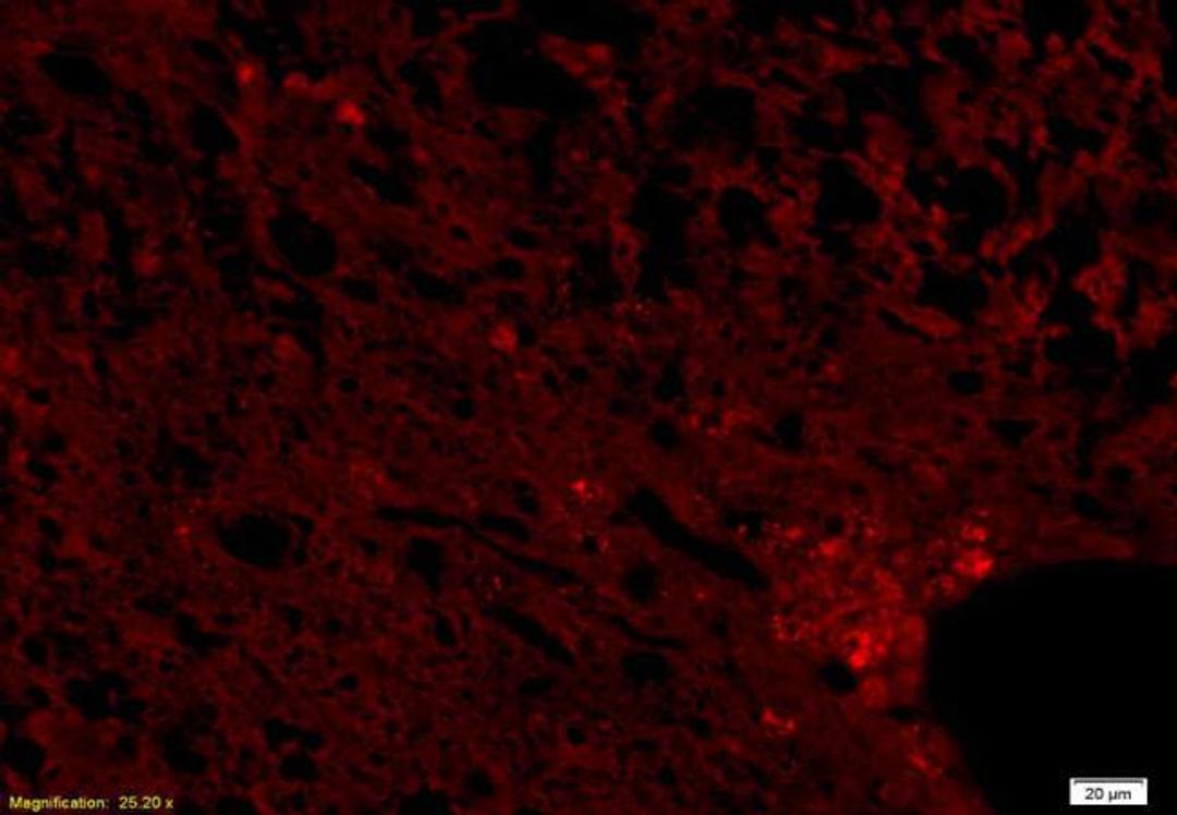 Immunofluorescence analysis of rat brain tissue using NCX3 antibody (1:200) 