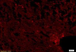 Immunofluorescence analysis of rat brain tissue using NCX3 antibody (1:200)