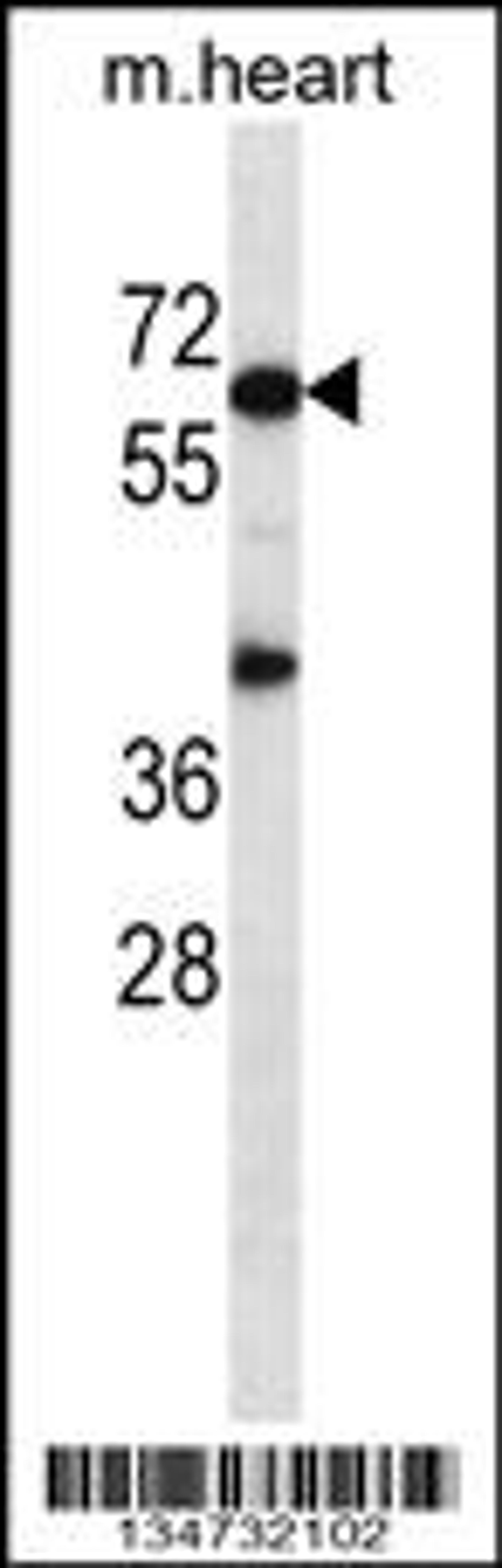 Western blot analysis in mouse heart tissue lysates (35ug/lane).