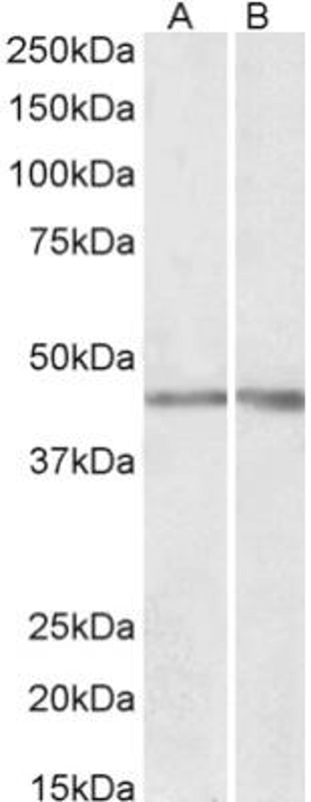 Western Blot: NPHS2 Antibody [NBP2-26057] - staining of Human (A) and Mouse (B) Kidney lysates (35 ug protein in RIPA buffer). Primary incubation was 1 hour. Detected by chemiluminescence.