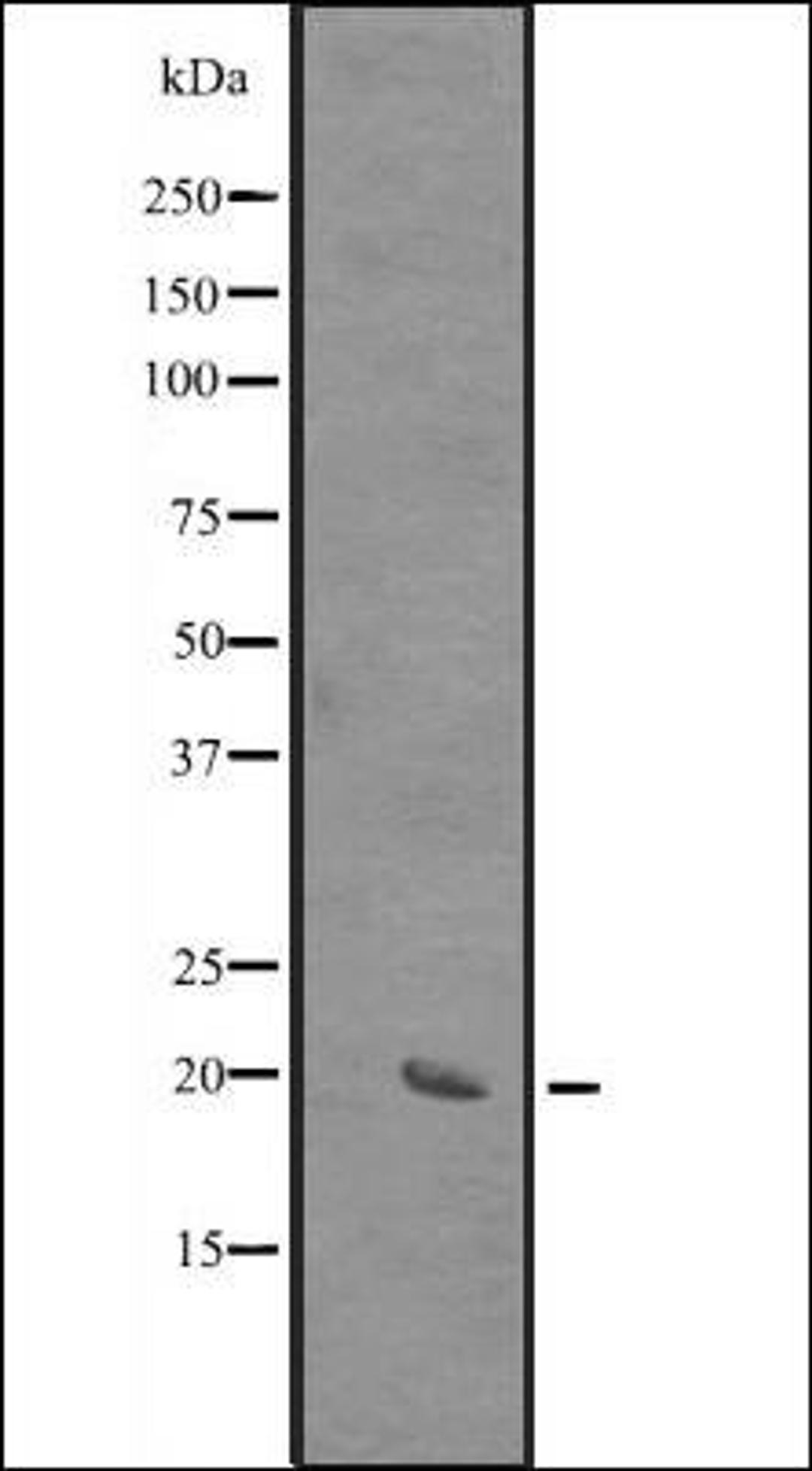 Western blot analysis of HEK293 cells using SIVA antibody