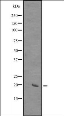 Western blot analysis of HEK293 cells using SIVA antibody