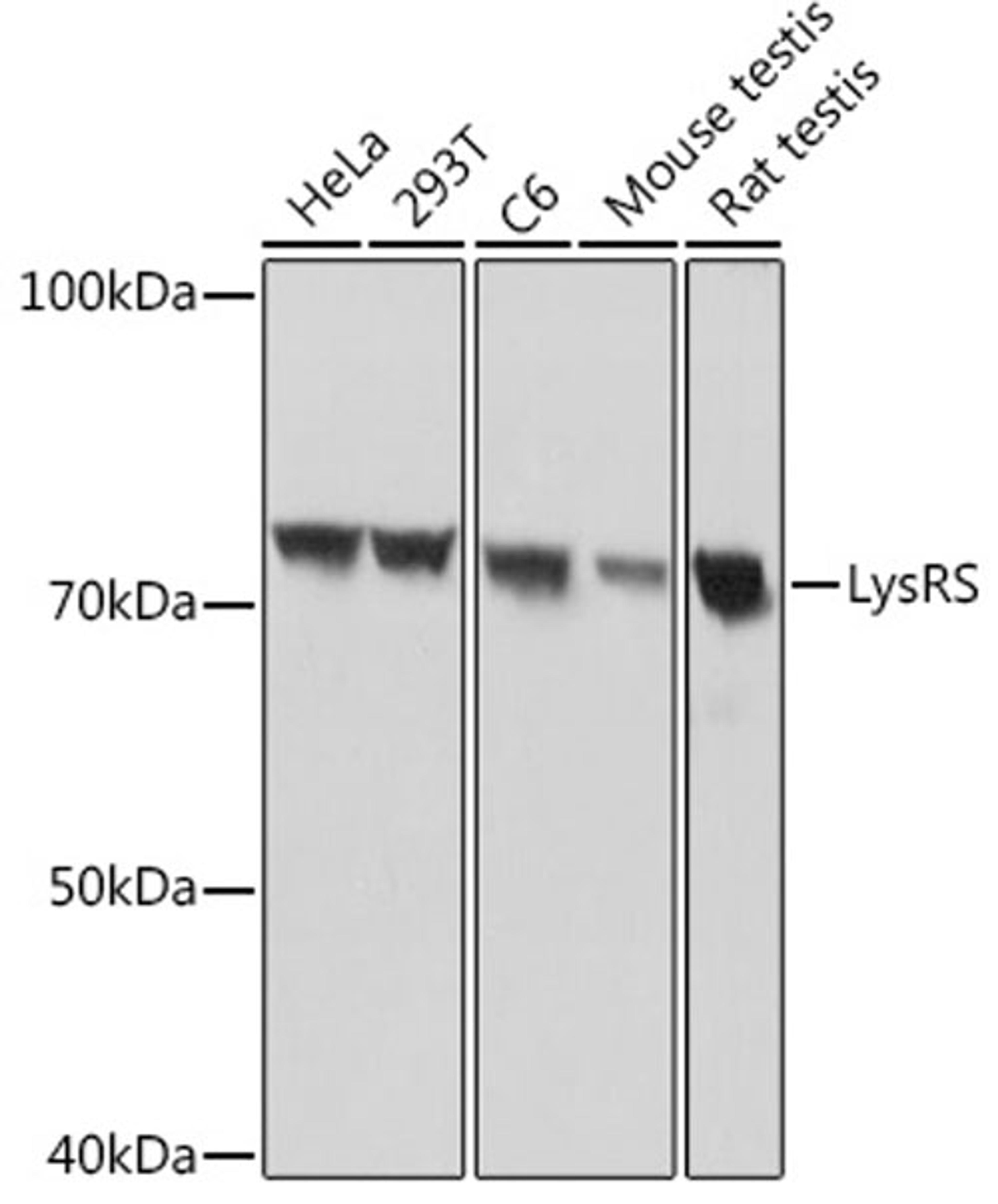 Western blot - LysRS Rabbit mAb (A8648)