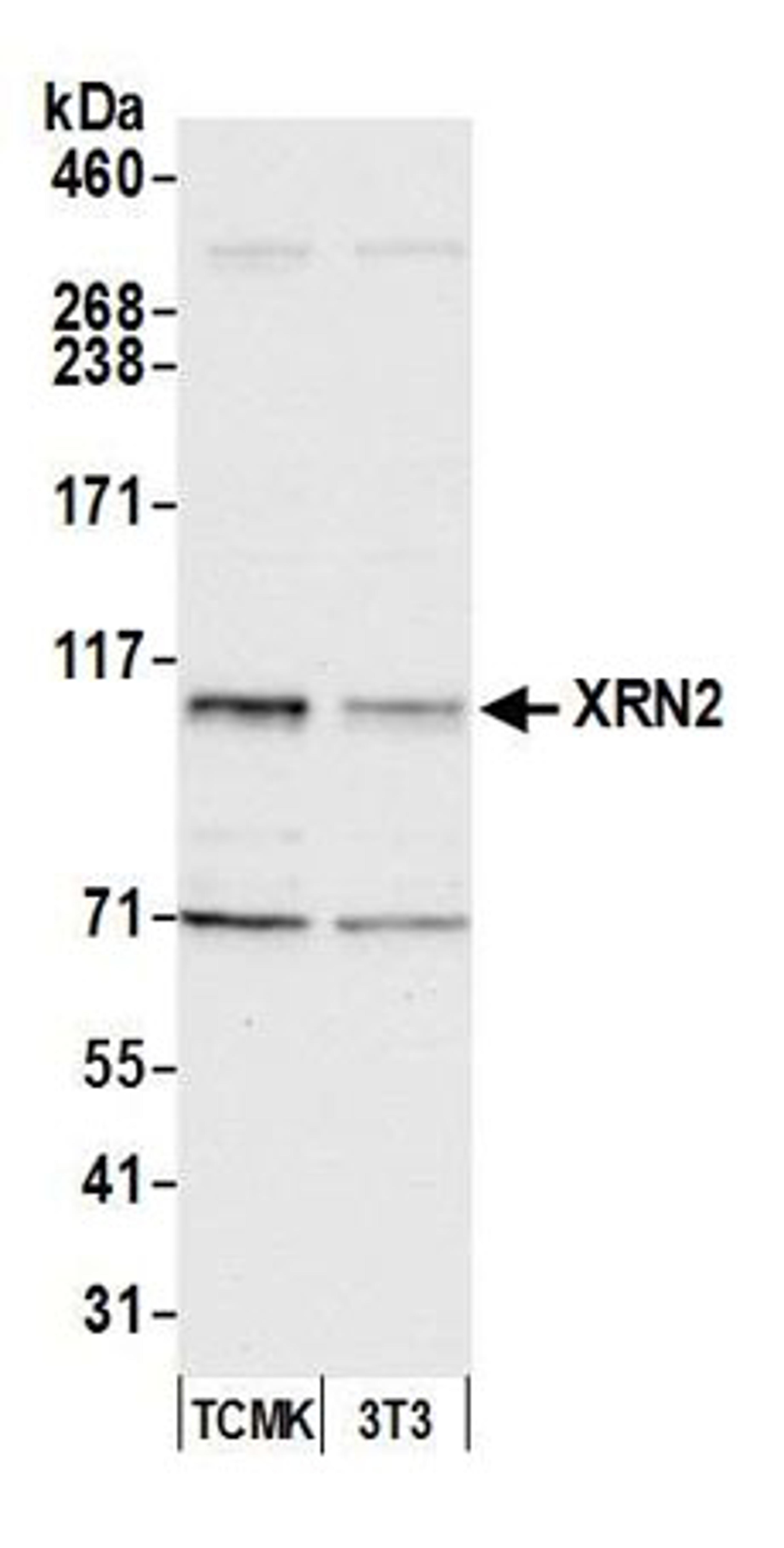 Detection of mouse XRN2 by western blot.