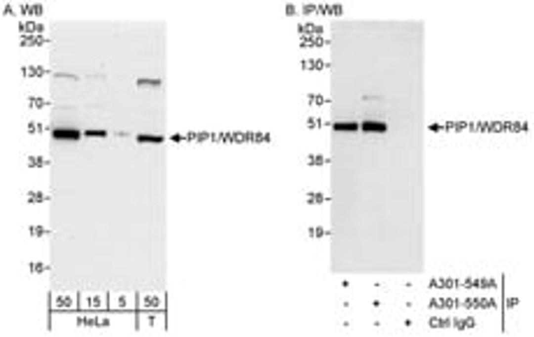 Detection of human PIP1/WDR84 by western blot and immunoprecipitation.