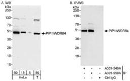 Detection of human PIP1/WDR84 by western blot and immunoprecipitation.