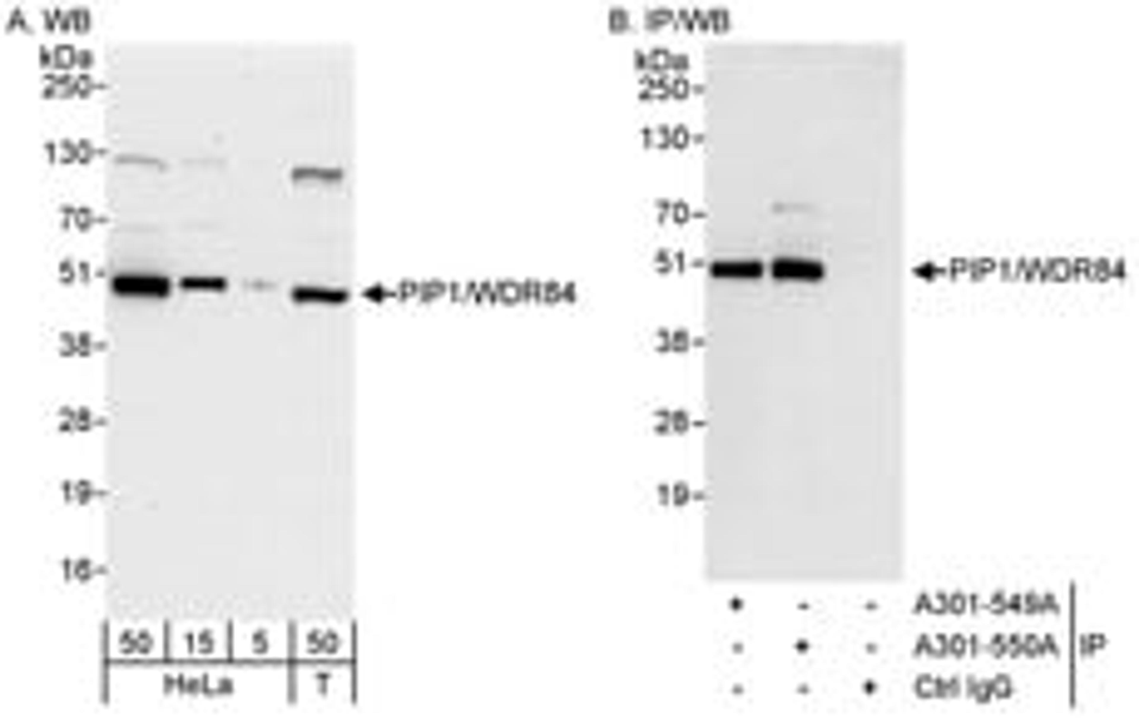 Detection of human PIP1/WDR84 by western blot and immunoprecipitation.