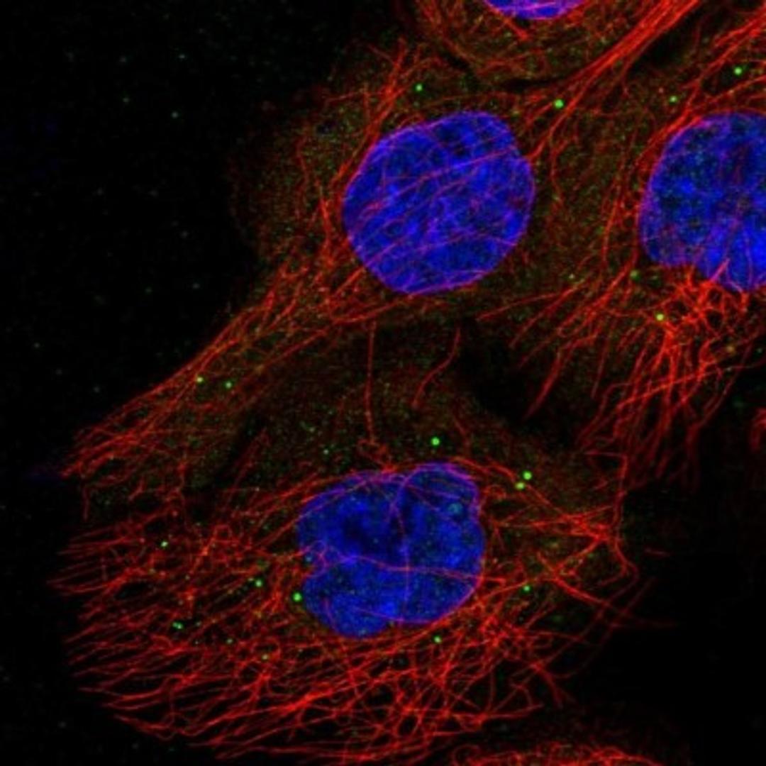 Immunocytochemistry/Immunofluorescence: RSPH3 Antibody [NBP1-84244] - Staining of human cell line A-431 shows positivity in vesicles.